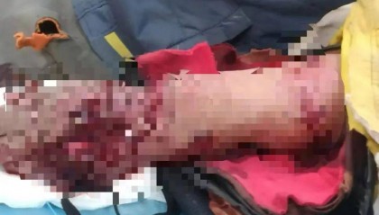 老虎扑咬 73 岁老人撞到铁栅栏,家属:老虎咬人后欲闯我家