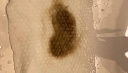 杭州部分小区居民反映自来水发臭,污染源仍不明