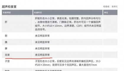 爱康国宾CEO曾揭行业造假黑幕:护士代替医生做超声检查,抽血后直接倒掉